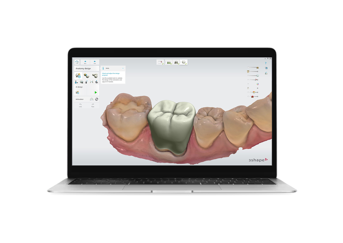 3Shape - Configurator